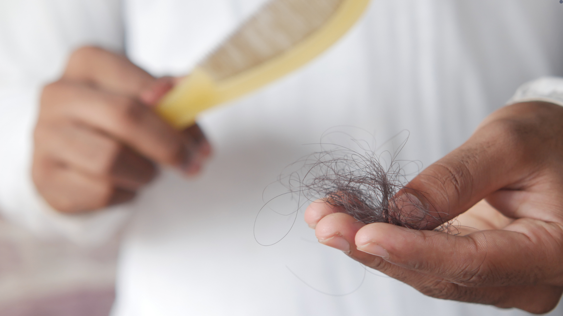 Exame tricoscópico para avaliação de queda capilar